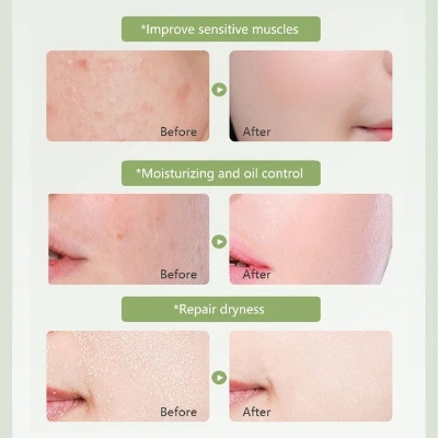 Picture of Aloe Vera 99% Moisturize Shooting Gel