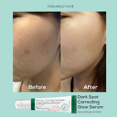 Picture of Mini Dark Spot Correcting Glow Serum 5 ml