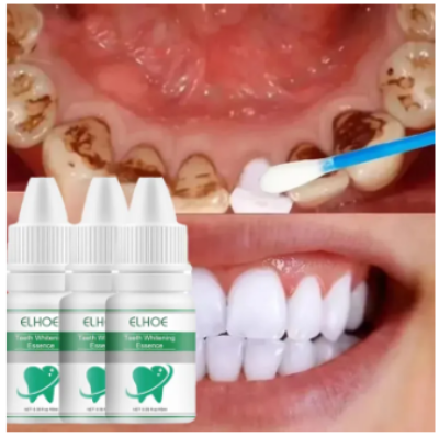 Picture of ELHOE Teeth Whitening Drops – 100% Natural Herbal Formula – Instantly Whitens Yellow Teeth, Removes Stains, Fights Bad Breath & Plaque – Strengthens Gums & Enamel – Safe for Sensitive Teeth – Fluoride-Free Liquid Oral Care for Men & Women