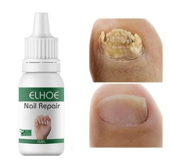 Picture of ELHOE Makes Your Nail Clean ELHOE Nail Repair Serum Nail Repair Oil 15ML