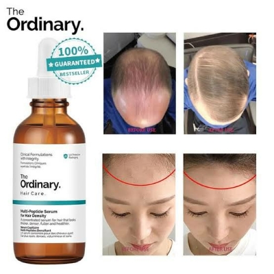 Picture of The Ordinary Hair Care Multi-Peptide Serum