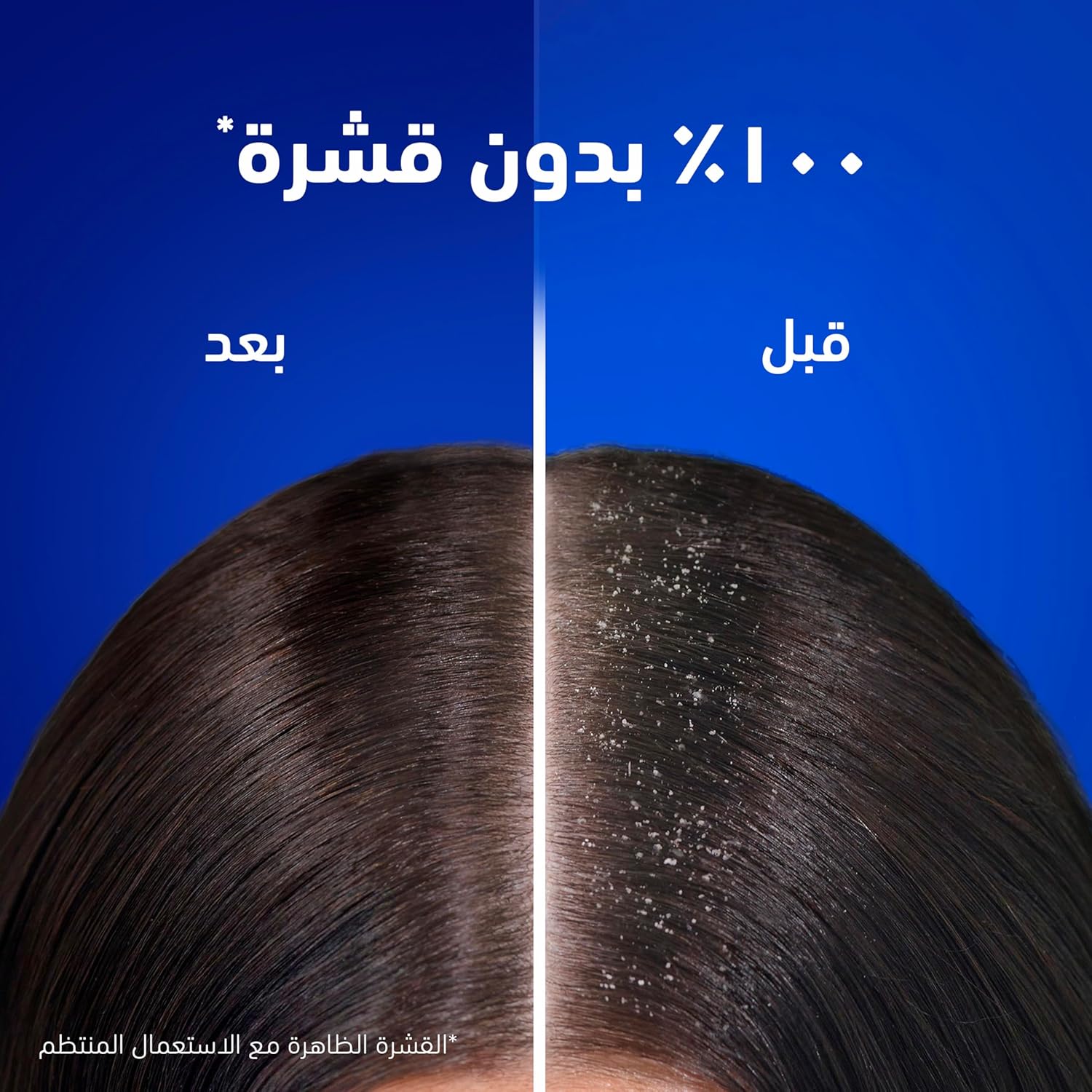 Picture of Head & Shoulders Menthol Refresh Anti-Dandruff Shampoo With Menthol 400 Ml