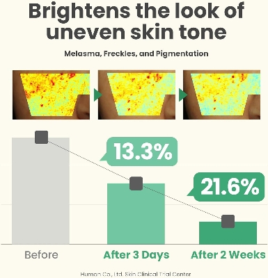 Picture of AXIS-Y Dark Spot Correcting Glow Serum 50ml / 1.69 fl. oz | Brightening Serum | Korean Skincare, Dark Spot Treatment, Hyperpigmentation Treatment