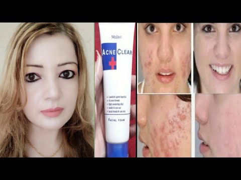 Picture of MISTINE ACNE CLEAR FACIAL FOAM 85G. Face Wash (Made In Thailand)