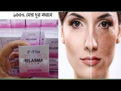 Picture of P Vita Melasma Cream 10gm (Thailand)