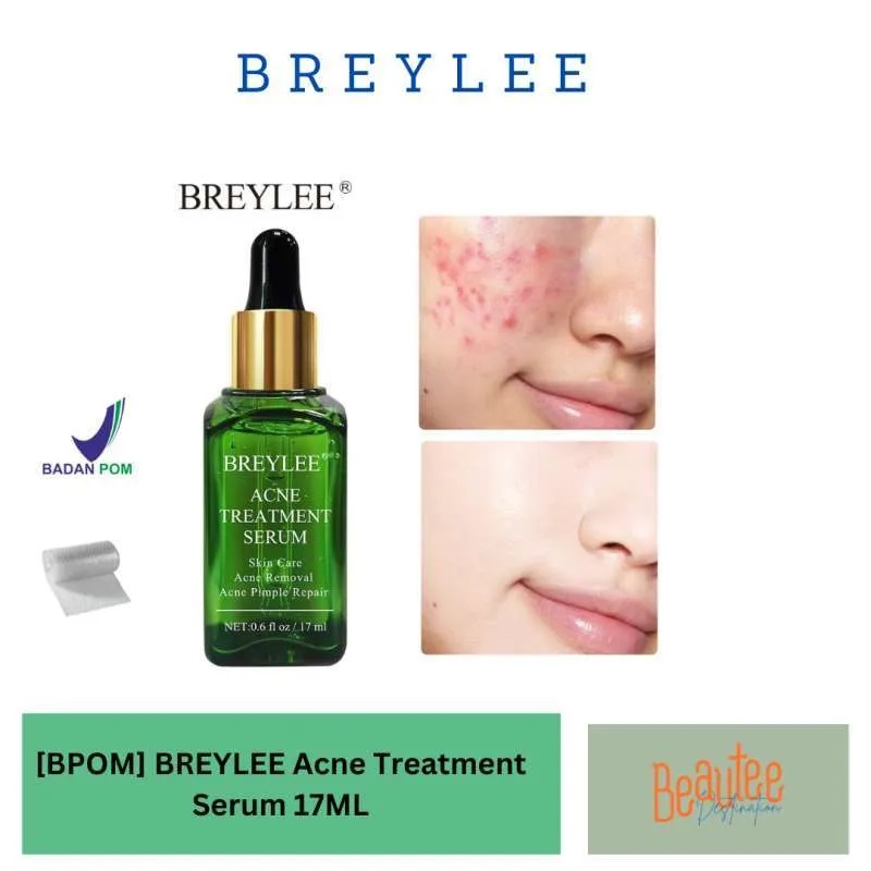 Picture of Acne Treatment Serum 17ml