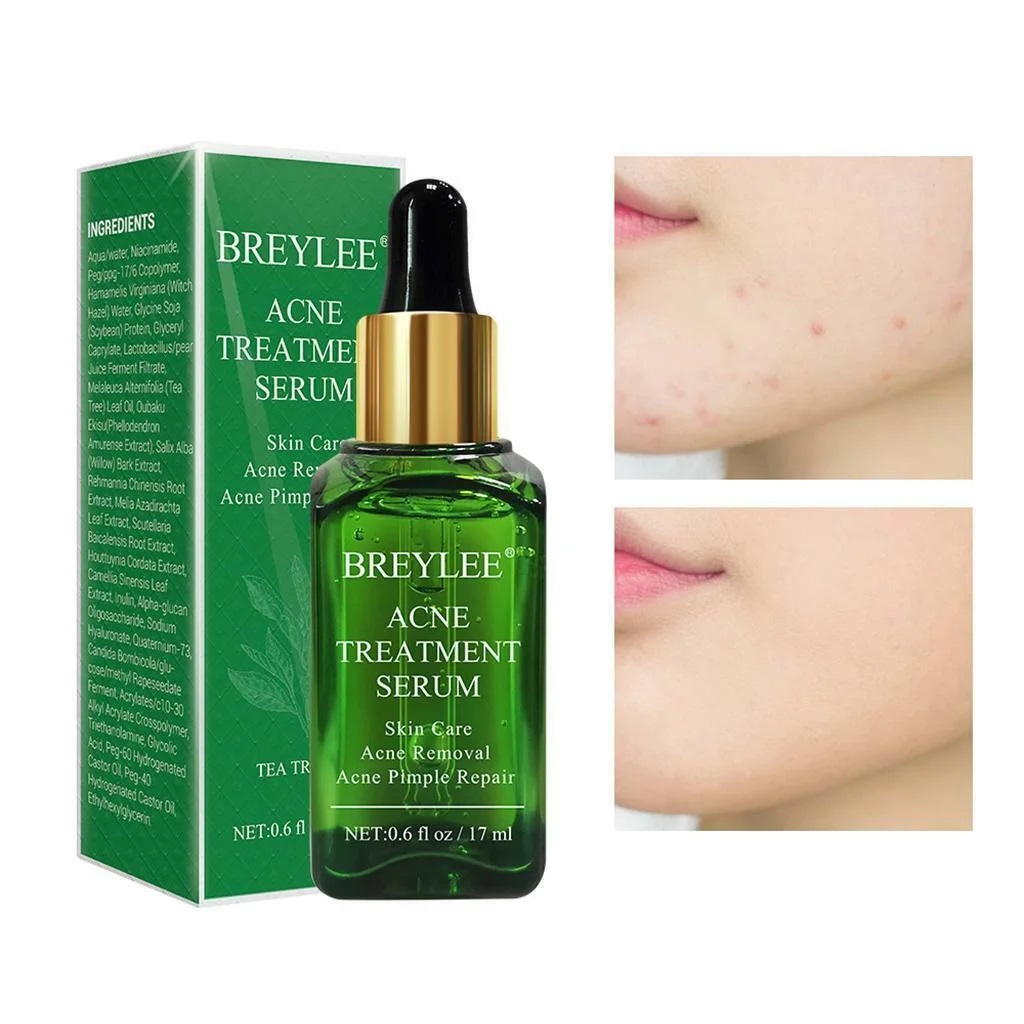 Picture of Acne Treatment Serum 17ml