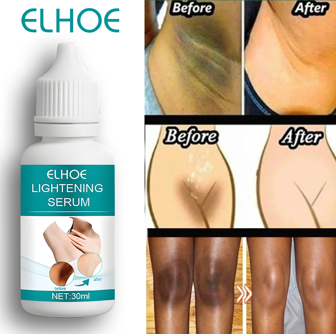 Picture of Get Brighter Underarms & Private Areas with ELHOE Lightening Serum. 30ml Natural Drop. Safe for Allergic Skin. Made for Bangladesh.