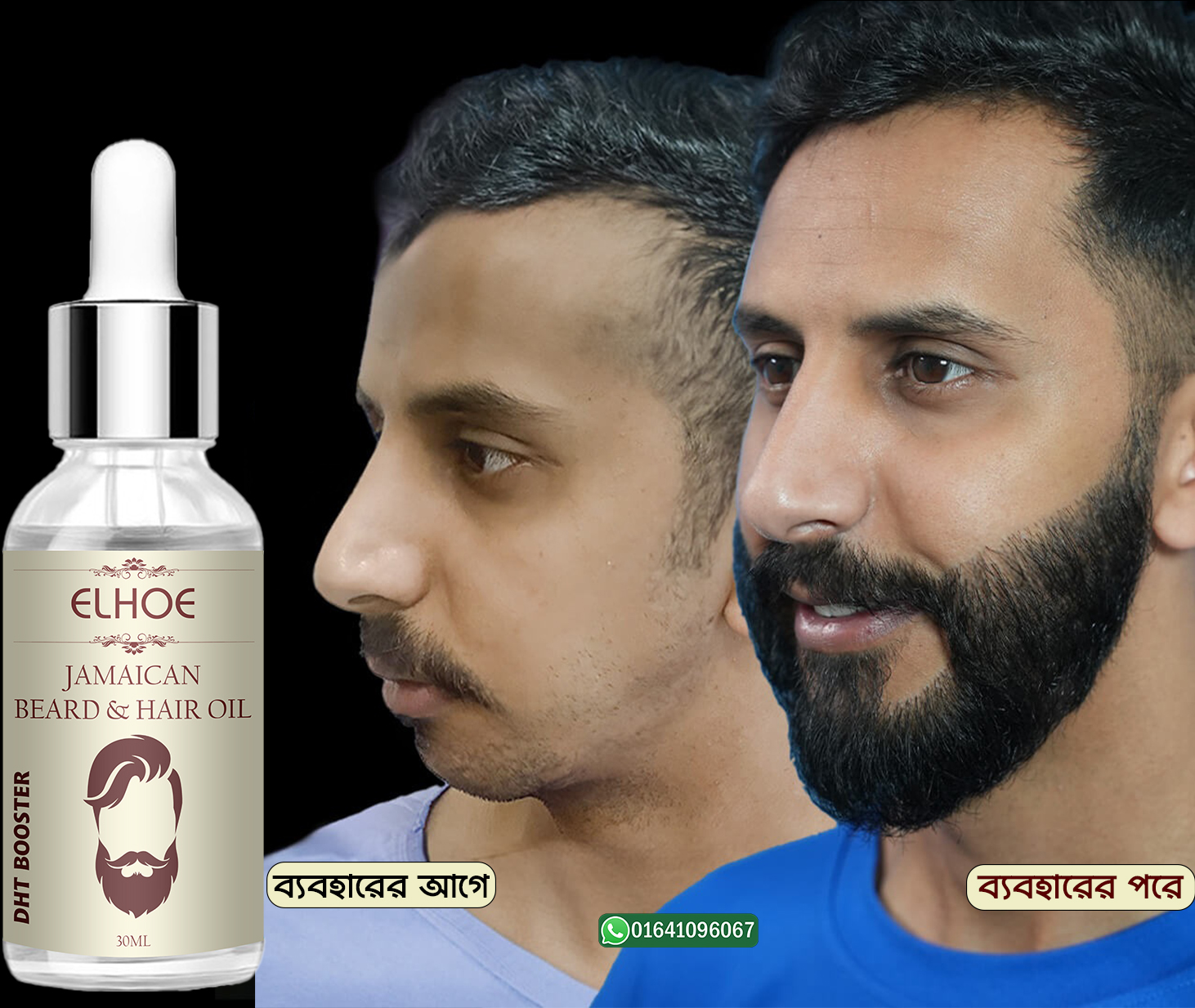 Picture of ELHOE Jamaican Beard and Hair Growth Oil – 100% Natural, Powerful, and Safe Natural Castor Oil With Good Benefits