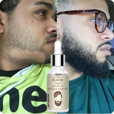 Picture of ELHOE Jamaican Beard and Hair Growth Oil – 100% Natural, Powerful, and Safe Natural Castor Oil With Good Benefits