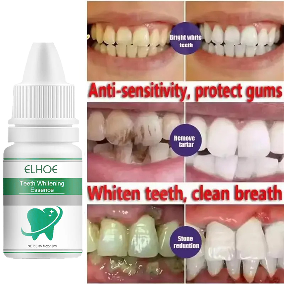 Picture of ELHOE Teeth Whitening Drops – 100% Natural Herbal Formula – Instantly Whitens Yellow Teeth, Removes Stains, Fights Bad Breath & Plaque – Strengthens Gums & Enamel – Safe for Sensitive Teeth – Fluoride-Free Liquid Oral Care for Men & Women
