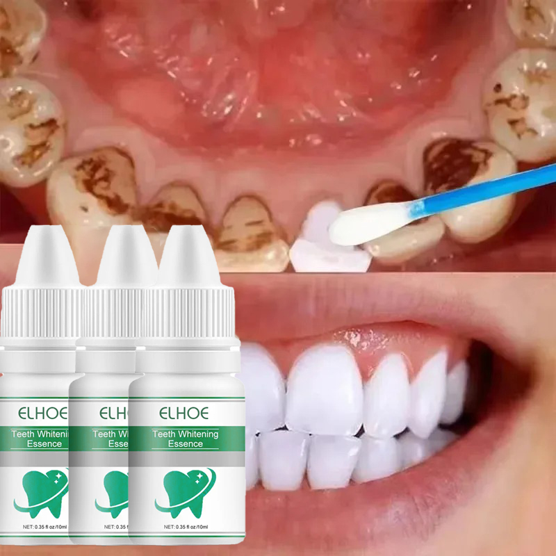 Picture of ELHOE Teeth Whitening Drops – 100% Natural Herbal Formula – Instantly Whitens Yellow Teeth, Removes Stains, Fights Bad Breath & Plaque – Strengthens Gums & Enamel – Safe for Sensitive Teeth – Fluoride-Free Liquid Oral Care for Men & Women