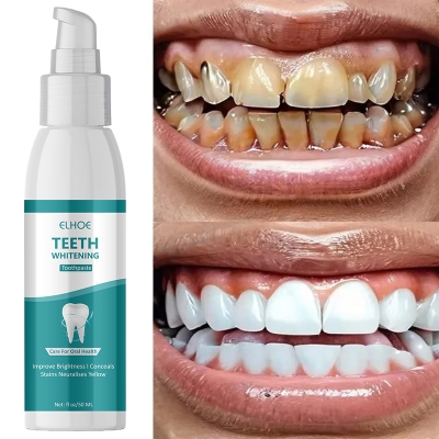Picture of ELHOE Teeth Whitening Toothpaste – 100% Natural Herbal Formula – Instantly Whitens Teeth, Removes Yellow Stains, Fights Plaque & Bad Breath – Strengthens Enamel – Fluoride-Free & Safe for Sensitive Gums – Daily Oral Care Toothpaste for Men & Women