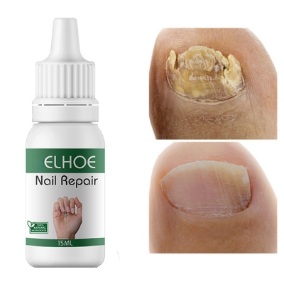 Picture of ELHOE Makes Your Nail Clean ELHOE Nail Repair Serum Nail Repair Oil 15ML elhoe.com