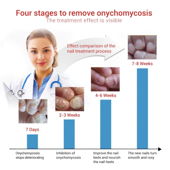 Picture of ELHOE Makes Your Nail Clean ELHOE Nail Repair Serum Nail Repair Oil 15ML elhoe.com