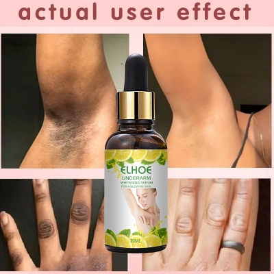 Picture of ELHOE Skin Face and Underarm Whitening serum for men and women Retinol EELHOE Face Serum
