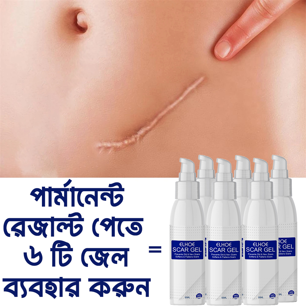 Picture of ELHOE Scar Removal Cream Gel Burn Surgical Scar Cesarean Scar Repairing Stretch Marks Pigmentation Corrector