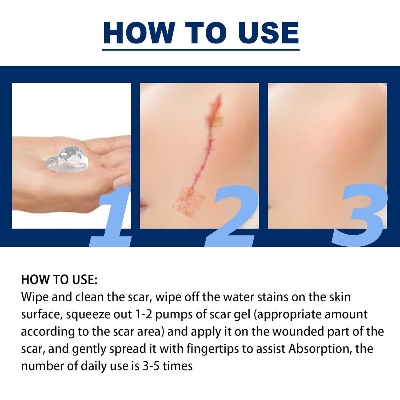 Picture of ELHOE Scar Removal Cream Gel Burn Surgical Scar Cesarean Scar Repairing Stretch Marks Pigmentation Corrector