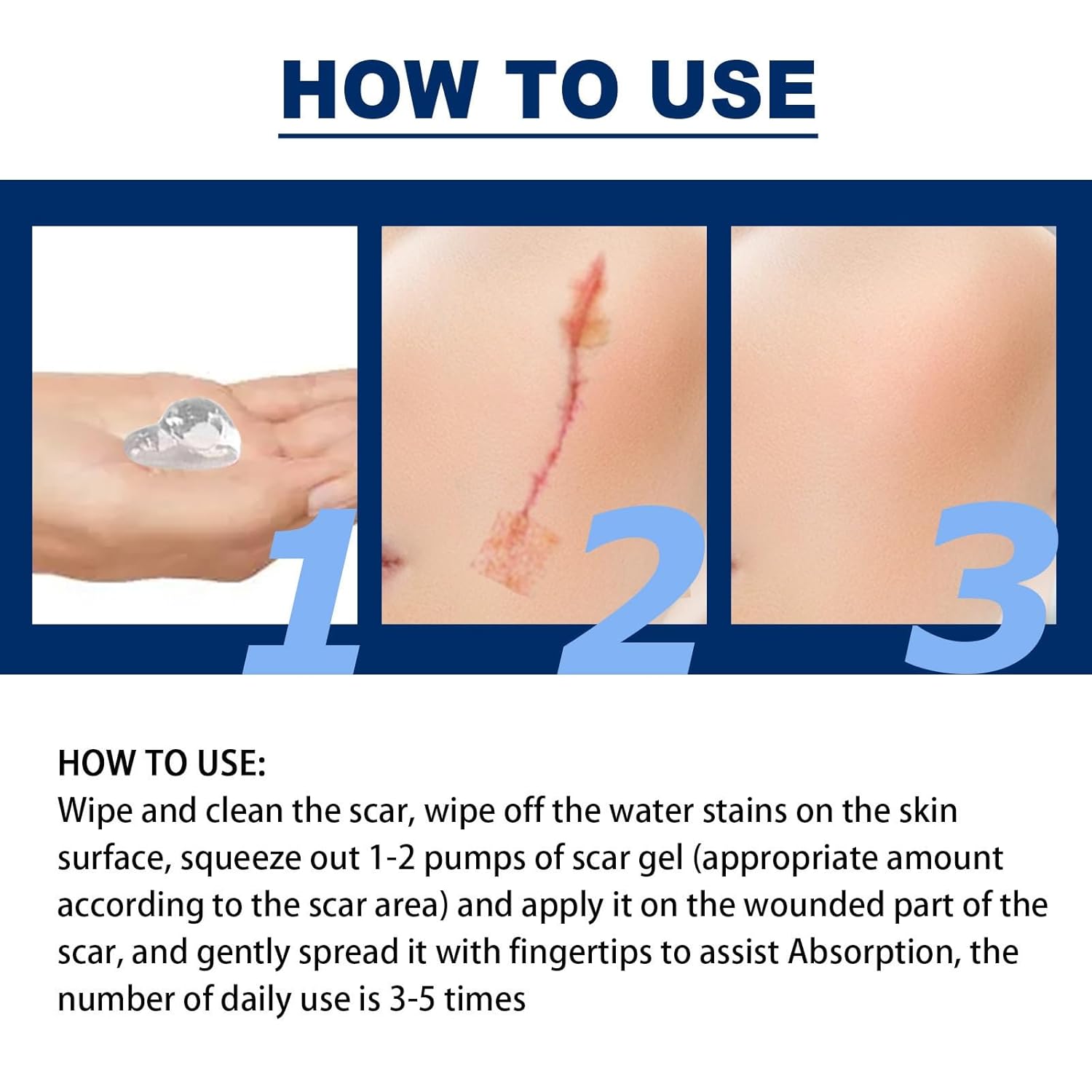 Picture of ELHOE Scar Removal Cream Gel Burn Surgical Scar Cesarean Scar Repairing Stretch Marks Pigmentation Corrector