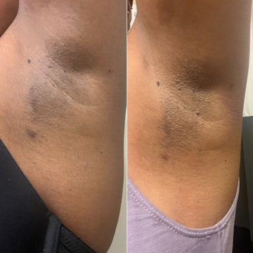 Picture of Intimify Serum Makes Your Underarm And Bikini Areas Cleaning And Hygiene Intimate Area Cleaner