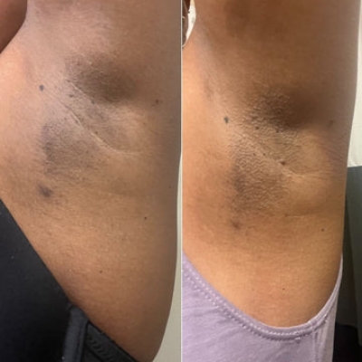 Picture of Intimify Serum Makes Your Underarm And Bikini Areas Cleaning And Hygiene Intimate Area Cleaner