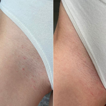 Picture of Intimify Serum Makes Your Underarm And Bikini Areas Cleaning And Hygiene Intimate Area Cleaner