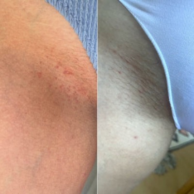 Picture of Intimify Serum Makes Your Underarm And Bikini Areas Cleaning And Hygiene Intimate Area Cleaner