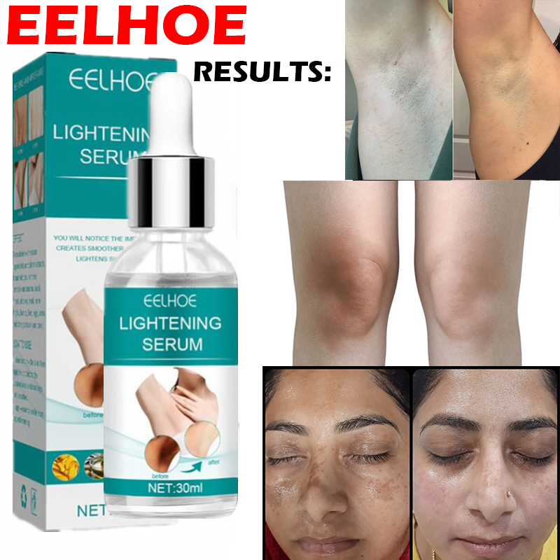 Picture of Korean ELHOE Serum Makes Your Underarm And Bikini Areas Cleaning And Hygiene Intimate Area Cleaner