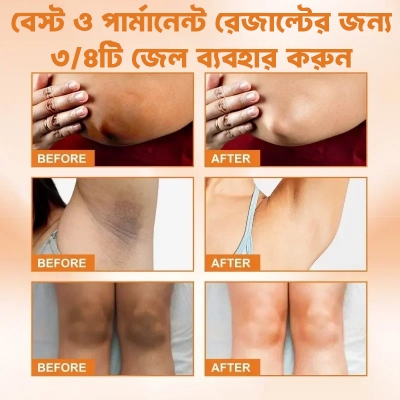 Picture of ELHOE Silicone Gel For Underarm and Dark Skin Areas EELHOE Lightening Serum