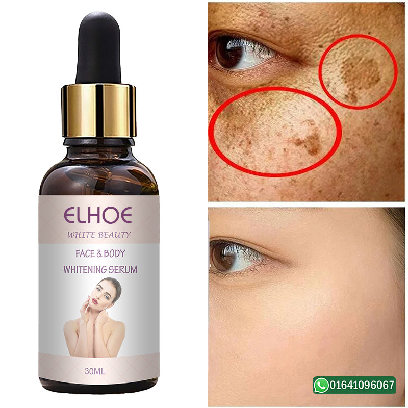 Picture of ELHOE Skin Face and Underarm Whitening serum for men and women Retinol EELHOE Face Serum