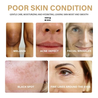 Picture of ELHOE Skin Face and Underarm Whitening serum for men and women Retinol EELHOE Face Serum