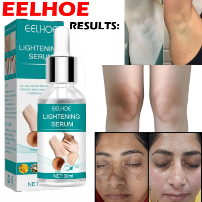 Picture of EELHOE Makes Brighter To Your Body And Posture Without Any Side Effect