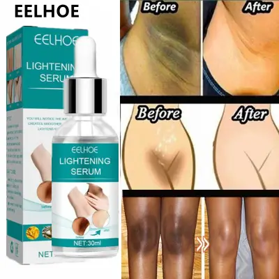 Picture of EELHOE Makes Brighter To Your Body And Posture Without Any Side Effect