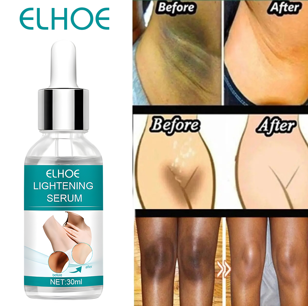 Picture of EELHOE Makes Brighter To Your Body And Posture Without Any Side Effect