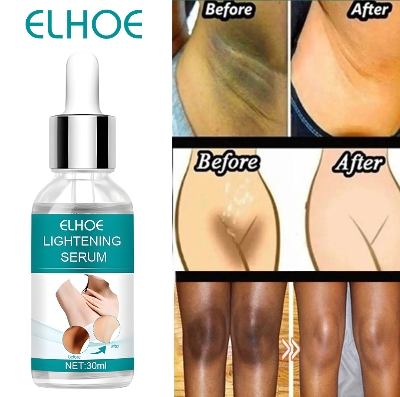 Picture of EELHOE Makes Brighter To Your Body And Posture Without Any Side Effect