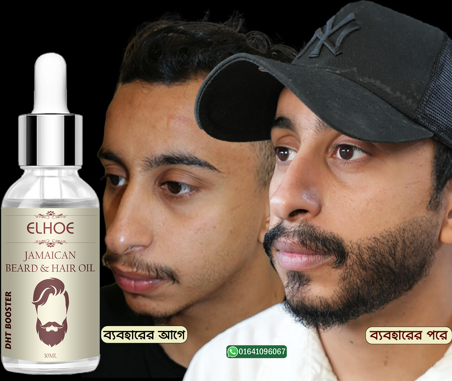 Picture of ELHOE Jamaican Beard and Hair Growth Oil – 100% Natural, Powerful, and Safe Natural Castor Oil With Good Benefits