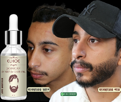 Picture of ELHOE Jamaican Beard and Hair Growth Oil – 100% Natural, Powerful, and Safe