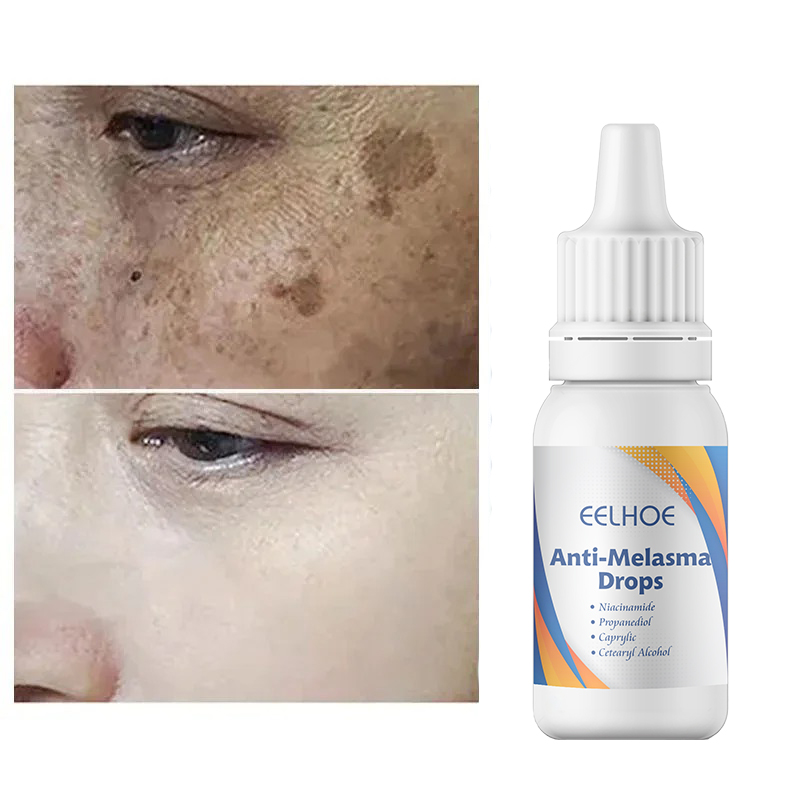 Picture of EELHOE Anti Melasma Drops – Brightening & Dark Spot Correcting Serum