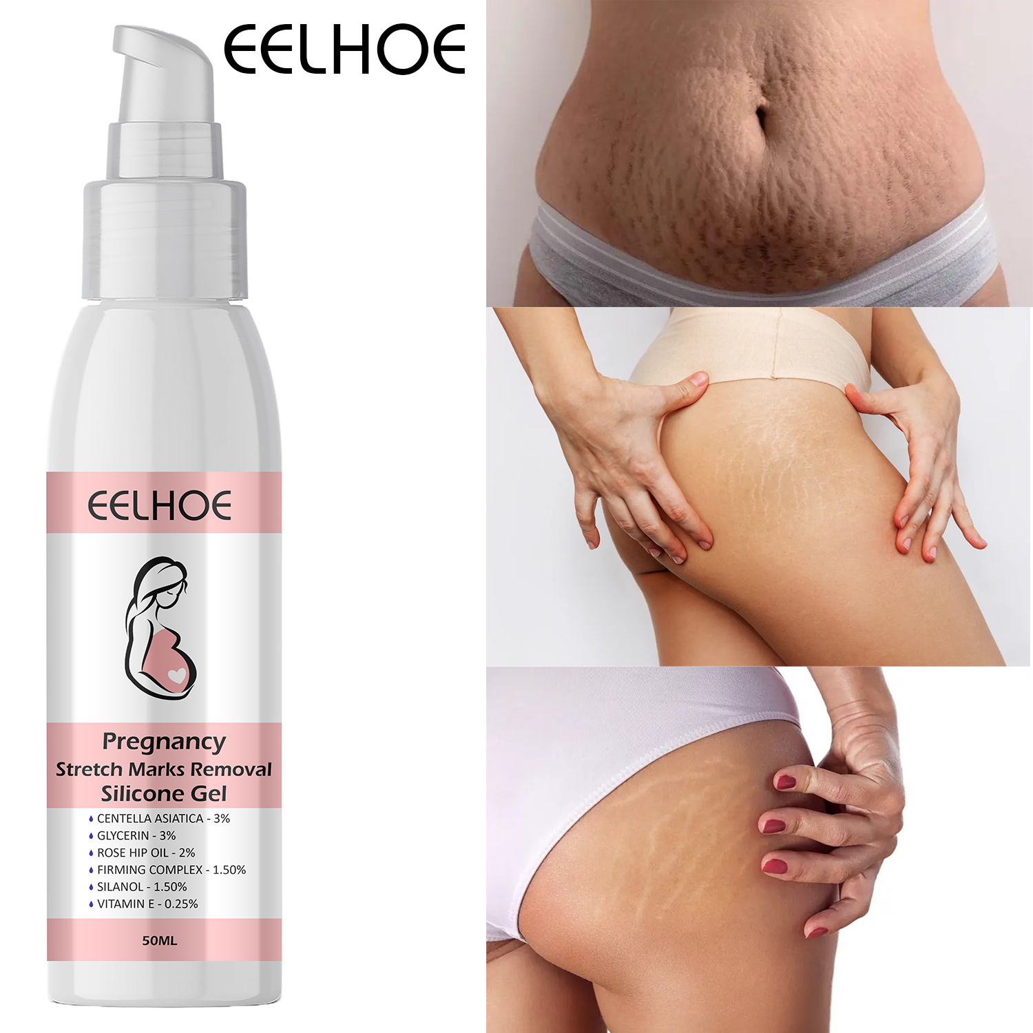 Picture of ELHOE Scar Removal Cream Gel Burn Surgical Scar Cesarean Scar Repairing Stretch Marks Pigmentation Corrector
