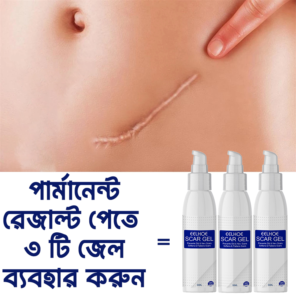 Picture of EELHOE Scar Removal Cream Gel Burn Surgical Scar Cesarean Scar Repairing Stretch Marks Pigmentation Corrector