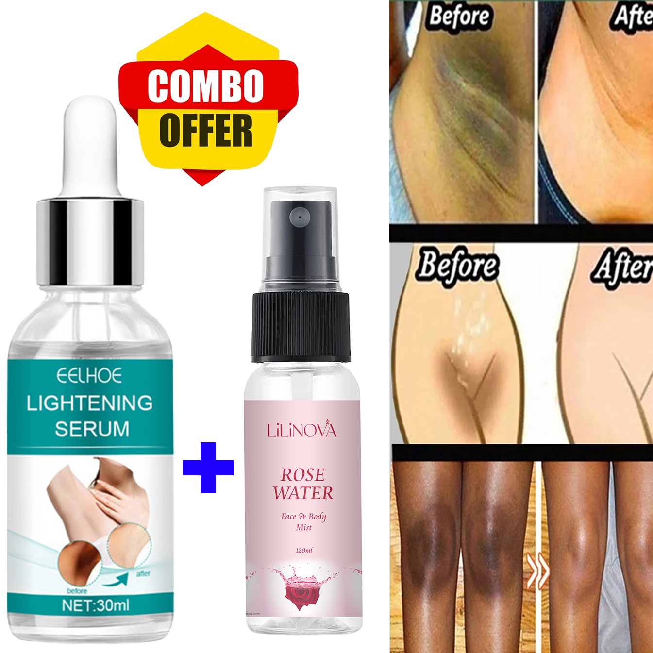 Picture of [111Tk Deal] Combo Offer EELHOE Lightening Serum and LiLiNOVA Rose Water For Underarm And Private area