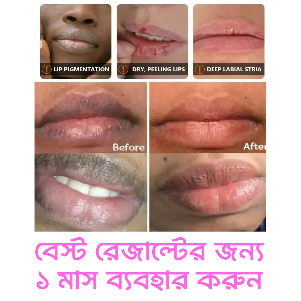 Picture of Remove Dark Lip Silicone Gel Lightening Melanin Mask chapped lips Gloss Gel Exfoliating Clean Moisturizer Korean Care Products Makeup Beauty Health