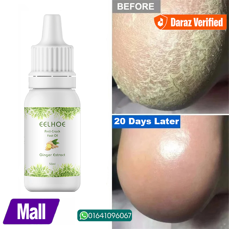 Picture of EELHOE Anti Crack Foot Hand Gel Ginger  Cuticles Care Anti-Drying Healing Crack Frost Mask Dead Skin Removal Deep Moisturizing Feet Crack Whitening Smooth Feet Care