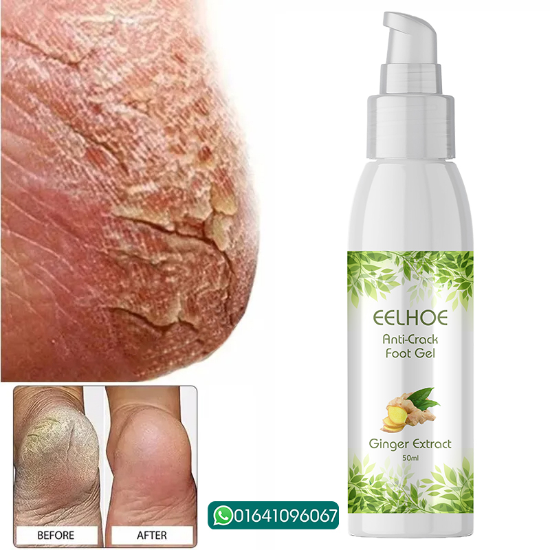 Picture of EELHOE Anti Crack Foot Hand Gel Ginger  Cuticles Care Anti-Drying Healing Crack Frost Mask Dead Skin Removal Deep Moisturizing Feet Crack Whitening Smooth Feet Care