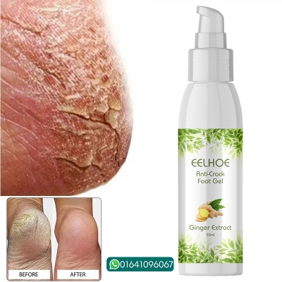 Picture of EELHOE Anti Crack Foot Hand Gel Ginger  Cuticles Care Anti-Drying Healing Crack Frost Mask Dead Skin Removal Deep Moisturizing Feet Crack Whitening Smooth Feet Care