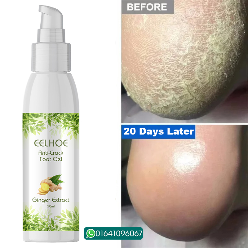 Picture of EELHOE Anti Crack Foot Hand Gel Ginger  Cuticles Care Anti-Drying Healing Crack Frost Mask Dead Skin Removal Deep Moisturizing Feet Crack Whitening Smooth Feet Care