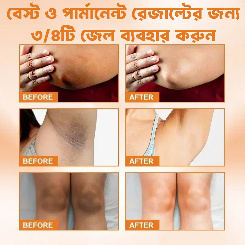 Picture of EELHOE Silicone Gel For Underarm and Dark Skin Areas EELHOE Lightening Serum