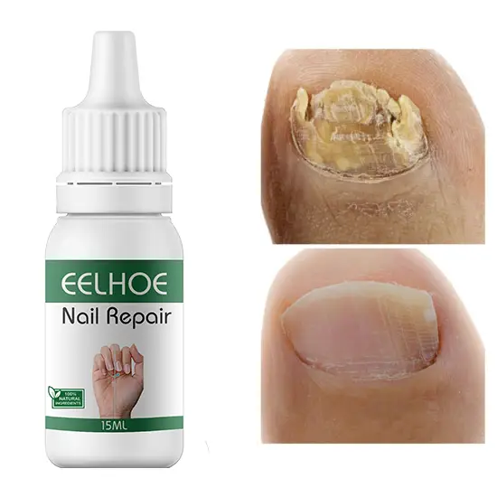 Picture of EELHOE Makes Your Nail Clean EELHOE Nail Repair Serum Nail Repair Oil 15ML