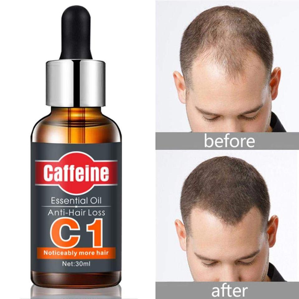 Picture of EELHOE Caffeine C1 Essential Oil Anti-Hair loss - 30ml