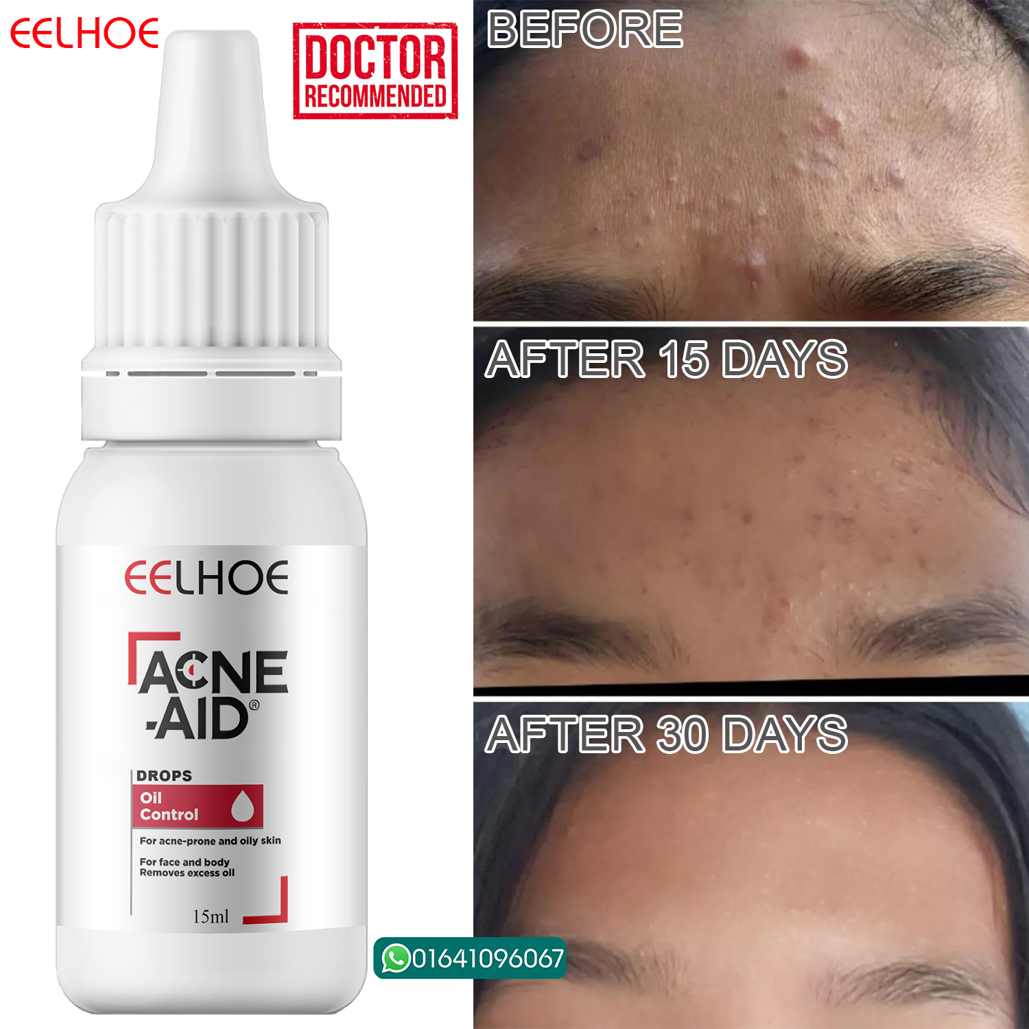 Picture of EELHOE Acne Aid Dr. Advice No.11 Acne Drops 15ml Doctor Recommended